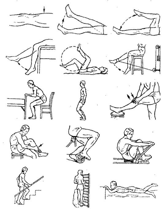 Exercicios terapéuticos para a artrose da articulación do xeonllo